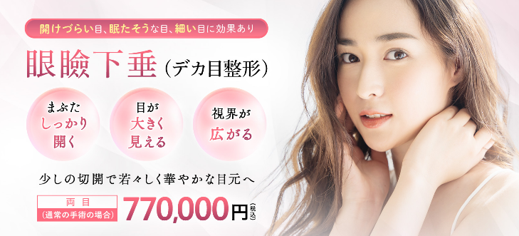 高須クリニック,デカ目形成